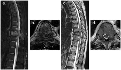 Different decision-making in spine metastasis management among radiation oncologists and orthopedic surgeons: a Korean online survey study